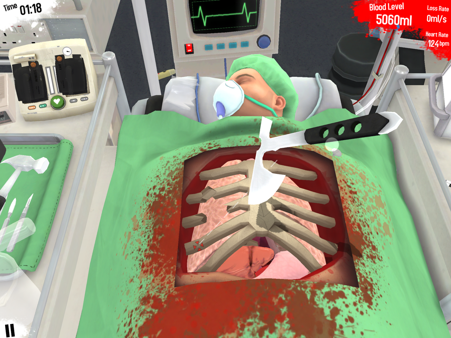 Surgeon Simulator (iOS) game review